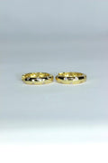 Aretes